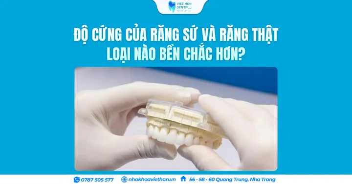 Độ cứng của răng sứ và răng thật loại nào bền chắc hơn?