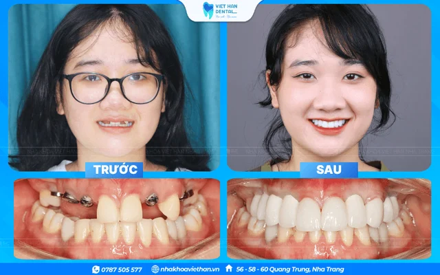Hình ảnh khách hàng 3 của Bác sĩ Khổng Văn Quân