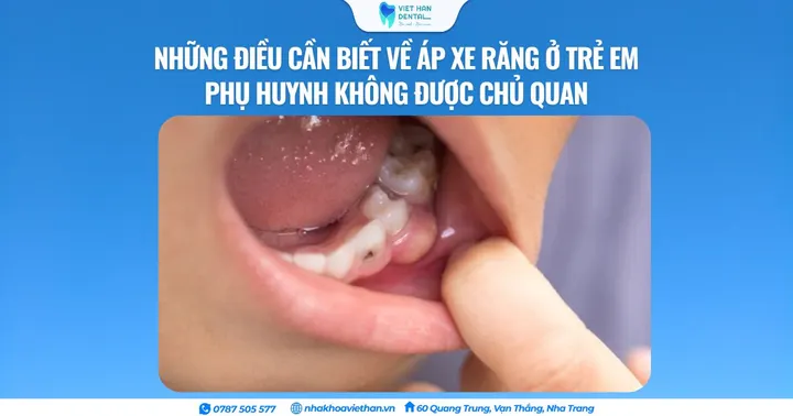 Những điều cần biết về áp xe răng ở trẻ em – Phụ huynh không được chủ quan