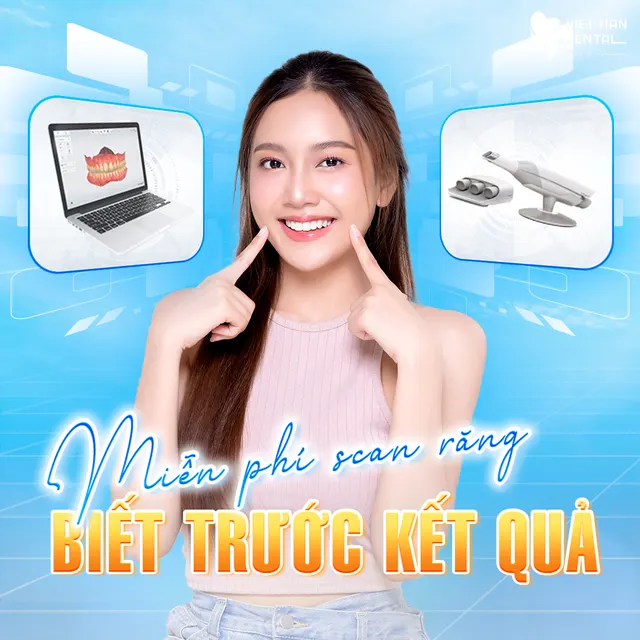 Miễn phí scan răng - biết trước kết quả