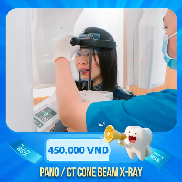 Ct