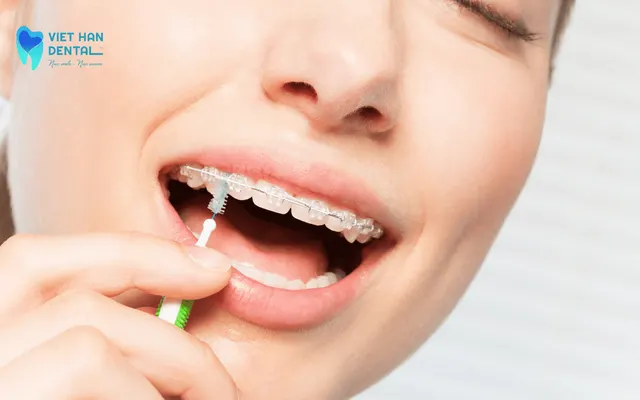 Sử dụng bàn chải kẽ