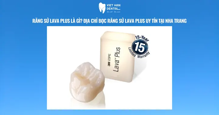 Răng sứ Lava Plus là gì? Địa chỉ bọc răng sứ Lava Plus uy tín tại Nha Trang