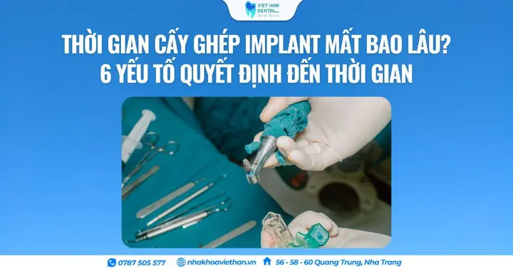 Thời gian cấy ghép Implant mất bao lâu? Yếu tố quyết định đến thời gian