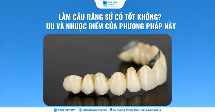Làm cầu răng sứ có tốt không? Ưu và nhược điểm của phương pháp này