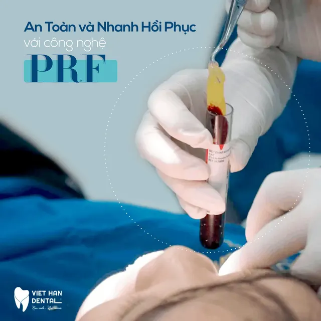 Lành thương nhanh chóng với công nghệ PRF 