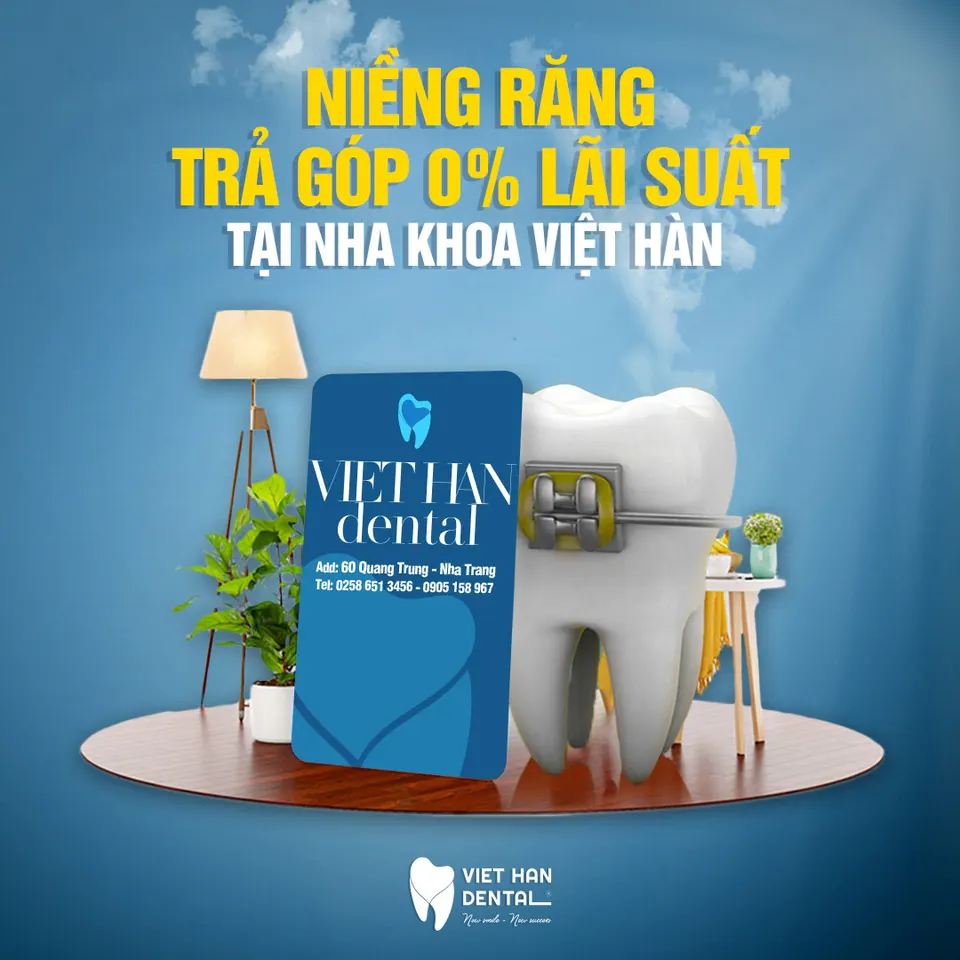 nieng-rang-tra-gop-tai-Nha-Trang-o-dau-uy-tin