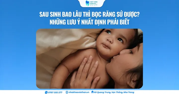 Sau sinh bao lâu thì bọc răng sứ được? Những lưu ý nhất định phải biết