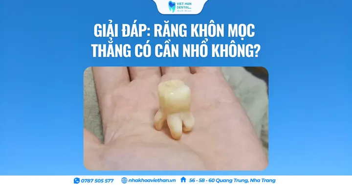 Giải đáp: Răng khôn mọc thẳng có cần nhổ không?