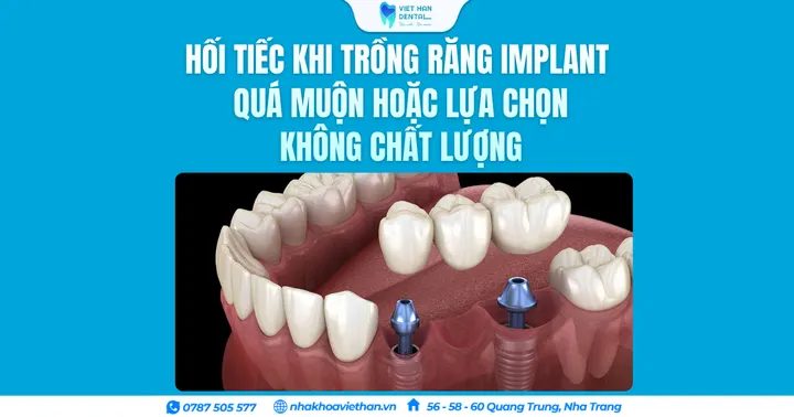 Hối tiếc khi trồng răng Implant quá muộn hoặc lựa chọn không chất lượng