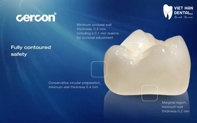 Cercon phù hợp với các trường hợp phục hình răng hàm.