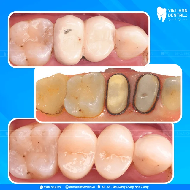 Hình ảnh khách hàng 6 của Bác sĩ Văn Thanh Nga