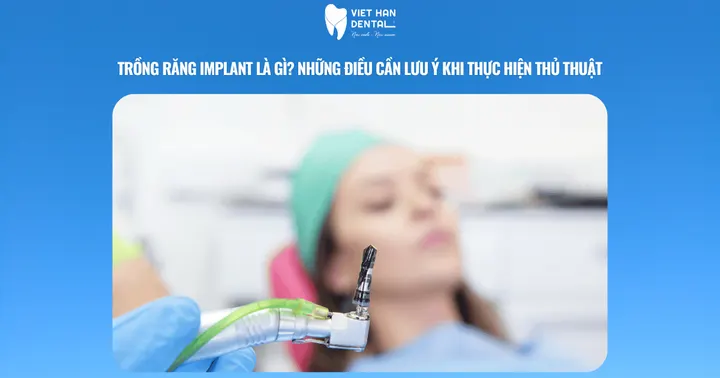 Những điều cần biết khi cấy ghép răng Implant