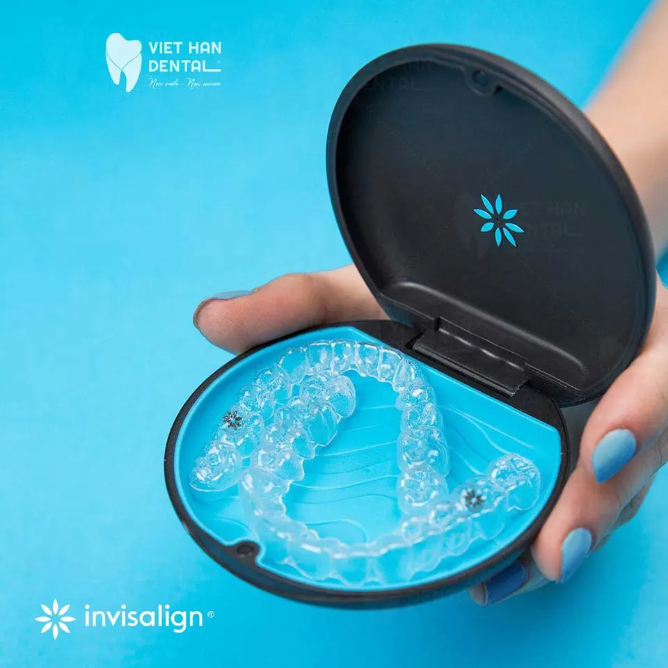 How Much Does Orthodontic Treatment Cost 5