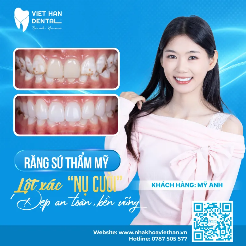 Kh Trước Sau Có Thông Tin (1)