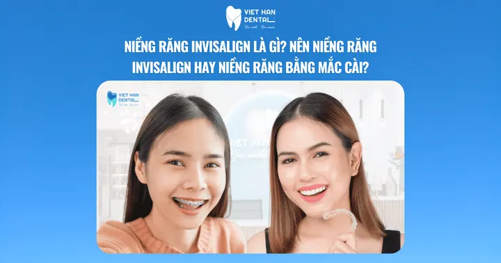 Niềng răng Invisalign là gì? Nên niềng răng Invisalign hay niềng răng mắc cài?
