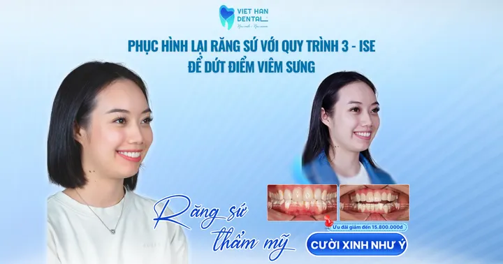 Phục hình lại răng sứ với quy trình 3 – ISE để dứt điểm viêm sưng