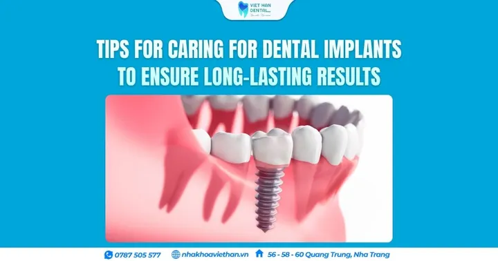Tips for caring for dental implants to ensure long-lasting results