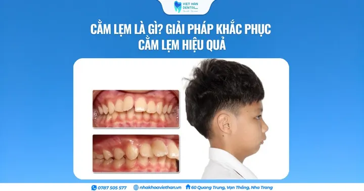 Cằm lẹm là gì? Giải pháp khắc phục cằm lẹm hiệu quả