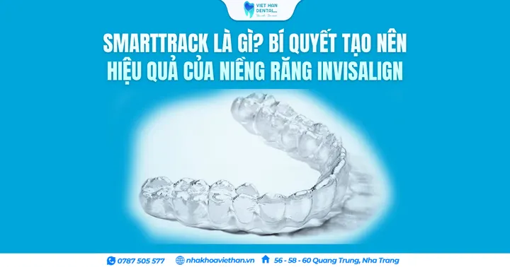 SmartTrack là gì? Bí quyết tạo nên hiệu quả của niềng răng Invisalign