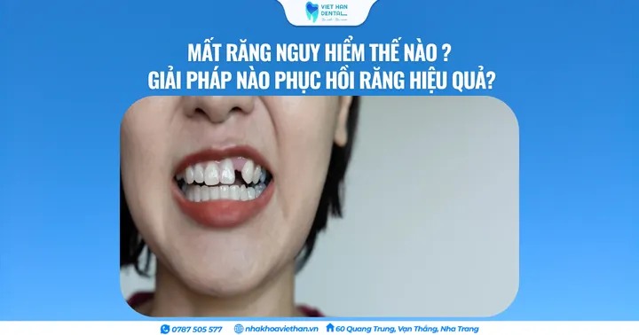 Mất răng nguy hiểm thế nào ? Giải pháp nào phục hồi răng hiệu quả?