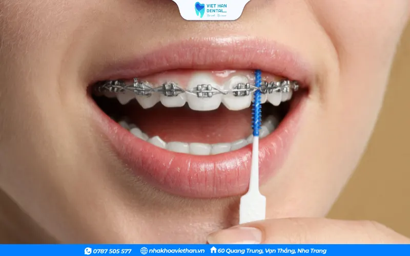 Vệ sinh răng miệng sạch sẽ