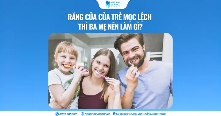 Răng cửa của trẻ mọc lệch thì ba mẹ nên làm gì?