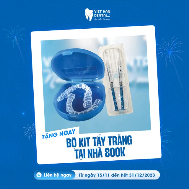 Bộ kit tẩy trắng răng tại nhà (Trị giá 800.000)