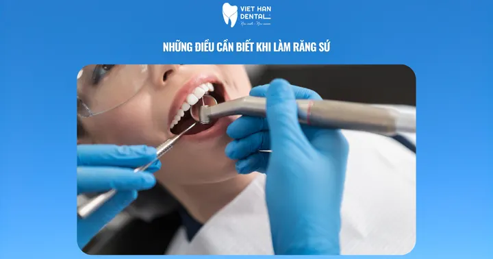 Những điều cần biết khi làm răng sứ