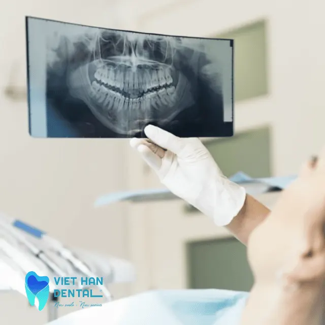 Phân biệt chụp X-quang và chụp CT trong nha khoa