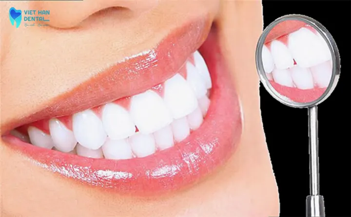 Giải pháp nào mang lại nụ cười đẹp xinh đón Tết?
