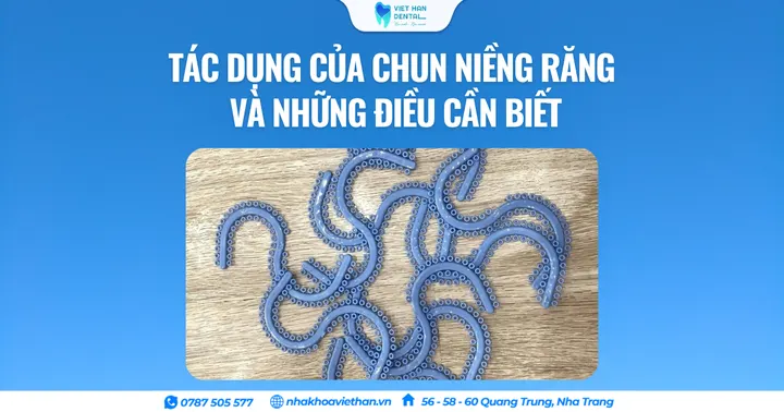 Tác dụng của chun niềng răng và những điều cần biết