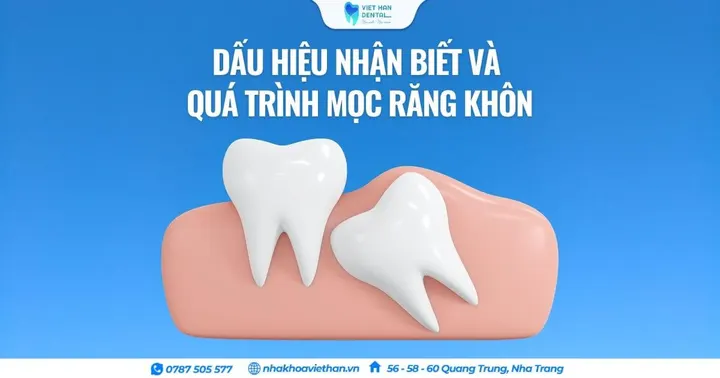 Dấu hiệu nhận biết và quá trình mọc răng khôn