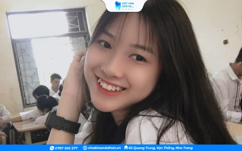 Nữ sinh có nụ cười răng khểnh