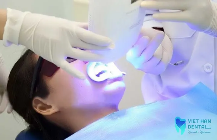 Nên tẩy trắng răng tại nhà hay tại nha khoa?