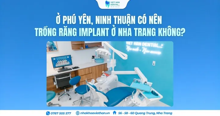 Ở Phú Yên, Ninh Thuận có nên trồng răng Implant ở Nha Trang không?