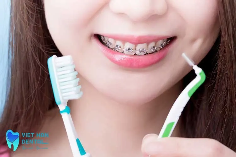 Nên sử dụng loại bàn chải nào khi niềng răng 