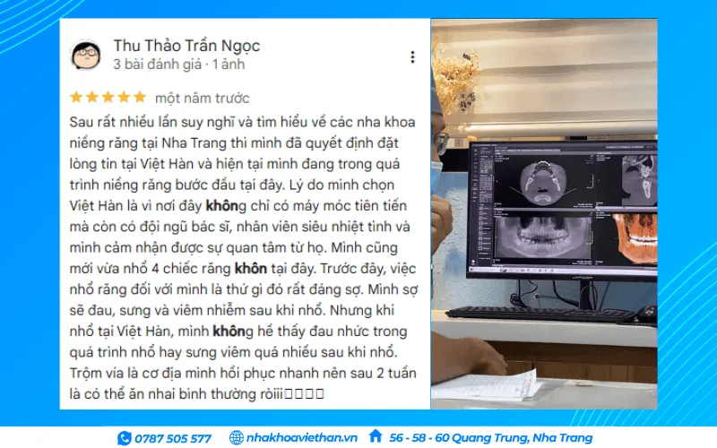Khách hàng đánh giá dịch vụ nhổ răng khôn tại Nha khoa Việt Hàn (Nguồn: Google Maps)