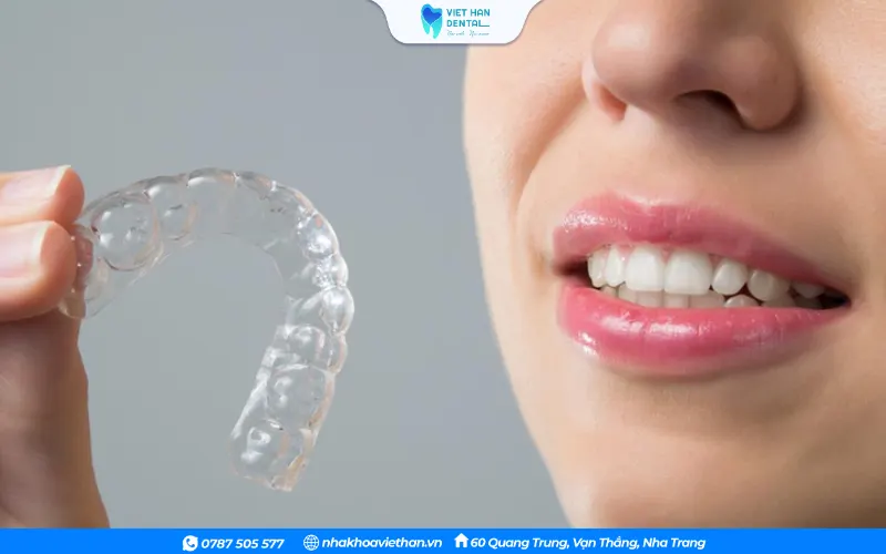 Sau khi tháo niềng đeo hàm duy trì giúp giữ răng ổn định ở vị trí mới