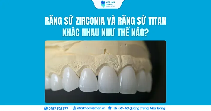 Răng sứ Zirconia và răng sứ Titan khác nhau như thế nào?