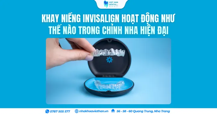Khay niềng Invisalign hoạt động như thế nào trong chỉnh nha hiện đại