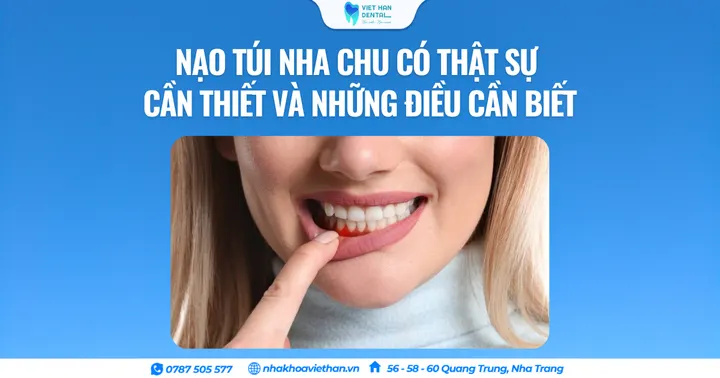 Nạo túi nha chu có thật sự cần thiết và những điều cần biết