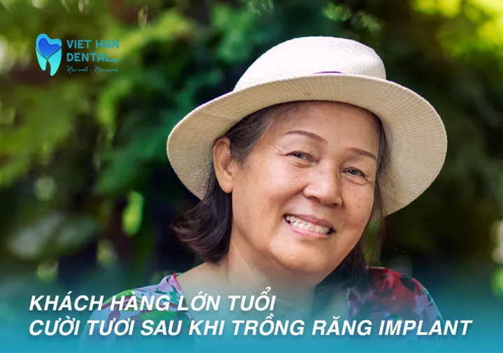Trồng Răng Implant All-On-4