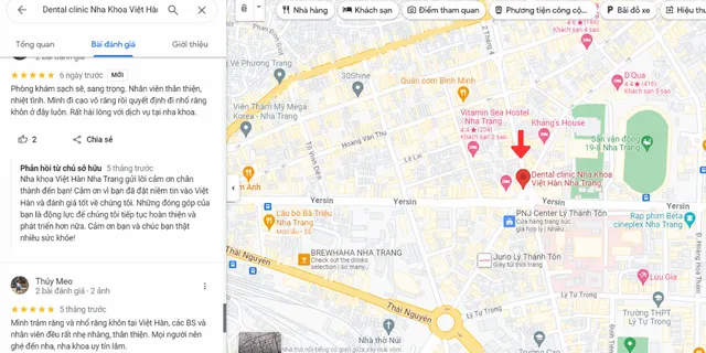Khách hàng review về dịch vị nhổ răng khôn tại Nha khoa Việt Hàn