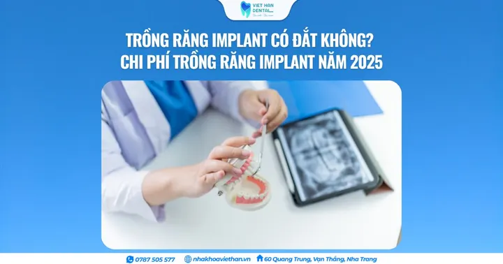 Trồng răng implant có đắt không? Chi phí trồng răng Implant năm 2025