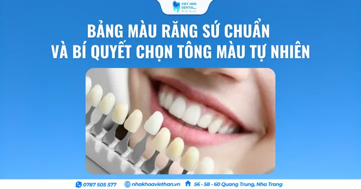 Bảng Màu Răng Sứ Chuẩn Và Bí Quyết Chọn Tông Màu Tự Nhiên