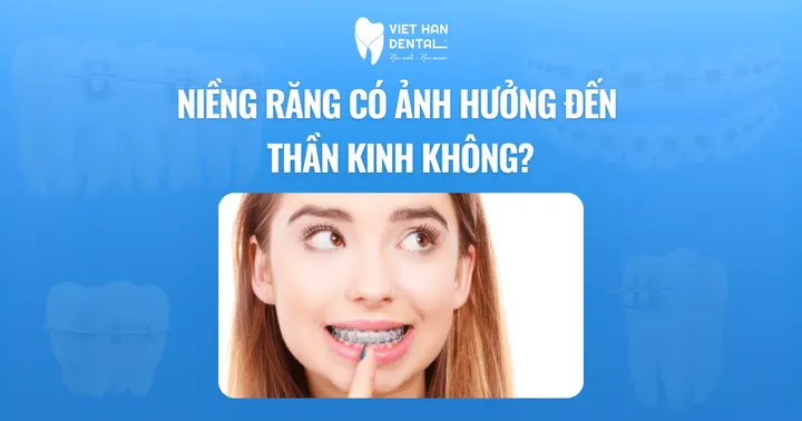 Niềng răng có ảnh hưởng đến thần kinh không?