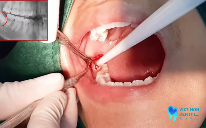 Kiểm tra cấu trúc liên quan