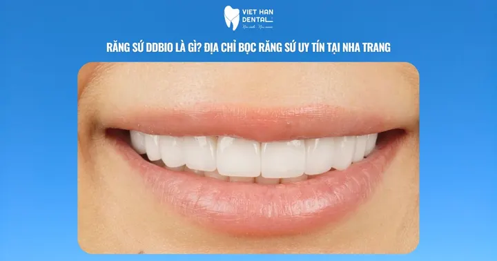 Răng sứ DDBio là gì? Địa chỉ bọc răng sứ uy tín tại Nha Trang