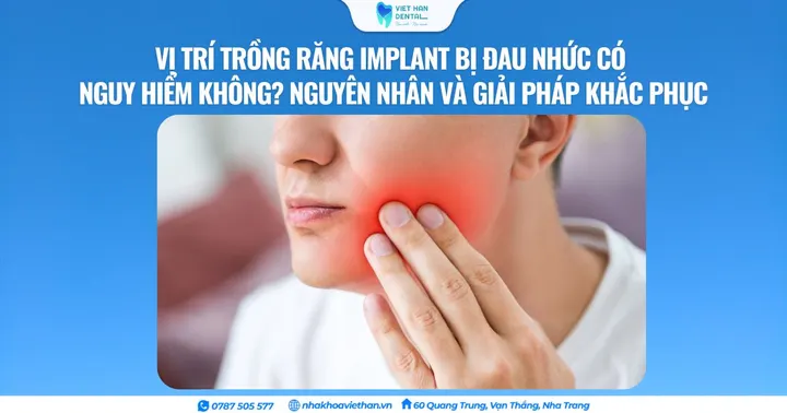 Vị trí trồng răng Implant bị đau nhức có nguy hiểm không? Nguyên nhân và giải pháp khắc phục